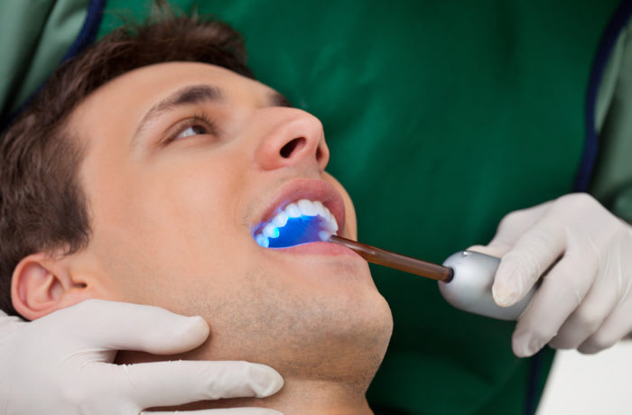 Снятие зубных отложений скалером